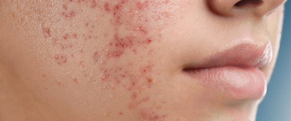 препарати 4